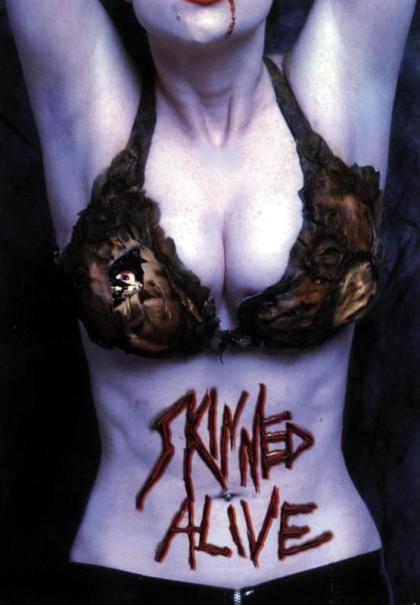 Skinned Alive