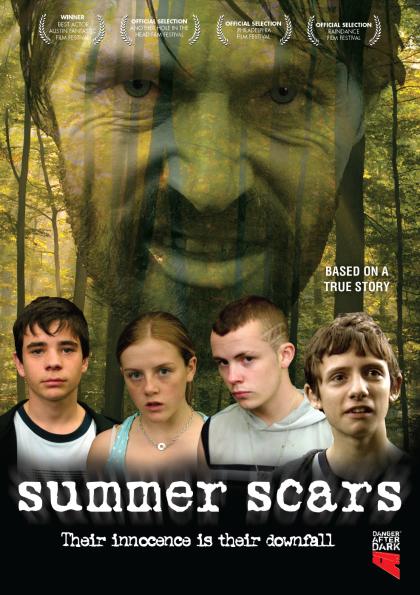 Summer Scars